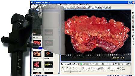 Pixera OrganStudio&trade;
