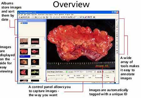 OrganStudio&trade; Software Overview