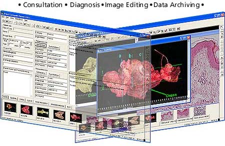 Pixera Telepathology System